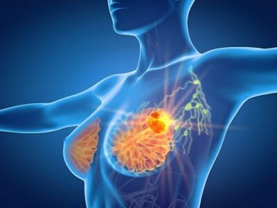 Buy Aromadexto Manage Estrogen Levels When Using Gears Aromadex